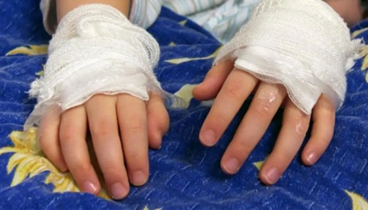 Un hombre prende fuego a su hijo tras rociarlo con gasolina; la pareja del agresor y la madre del joven también tienen quemaduras Un hombre prende fuego a su hijo tras rociarlo con gasolina; la pareja del agresor y la madre del joven también tienen quemaduras