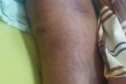 Militar aprehendido por supuesto acoso fue “torturado” y ahora lucha por su vida en un hospital, denuncia su familia 