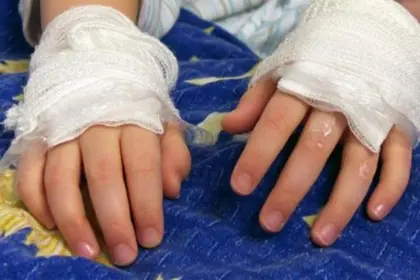 Un hombre prende fuego a su hijo tras rociarlo con gasolina; la pareja del agresor y la madre del joven también tienen quemaduras Un hombre prende fuego a su hijo tras rociarlo con gasolina; la pareja del agresor y la madre del joven también tienen quemaduras