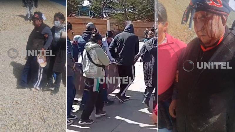 Los heridos durante el intento de desbloqueo. Los heridos durante el intento de desbloqueo.