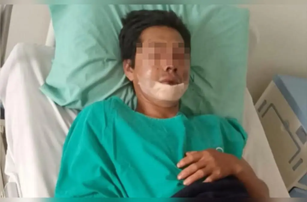 Los huesos “pueden dañar sus pulmones”: Sobreviviente en Samaipata tiene tres costillas y la nariz fracturadas