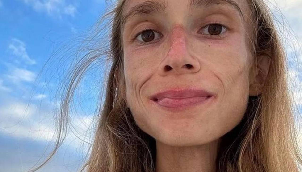Muere con desnutrición severa una joven de 27 años que seguía una dieta estricta a base de frutas