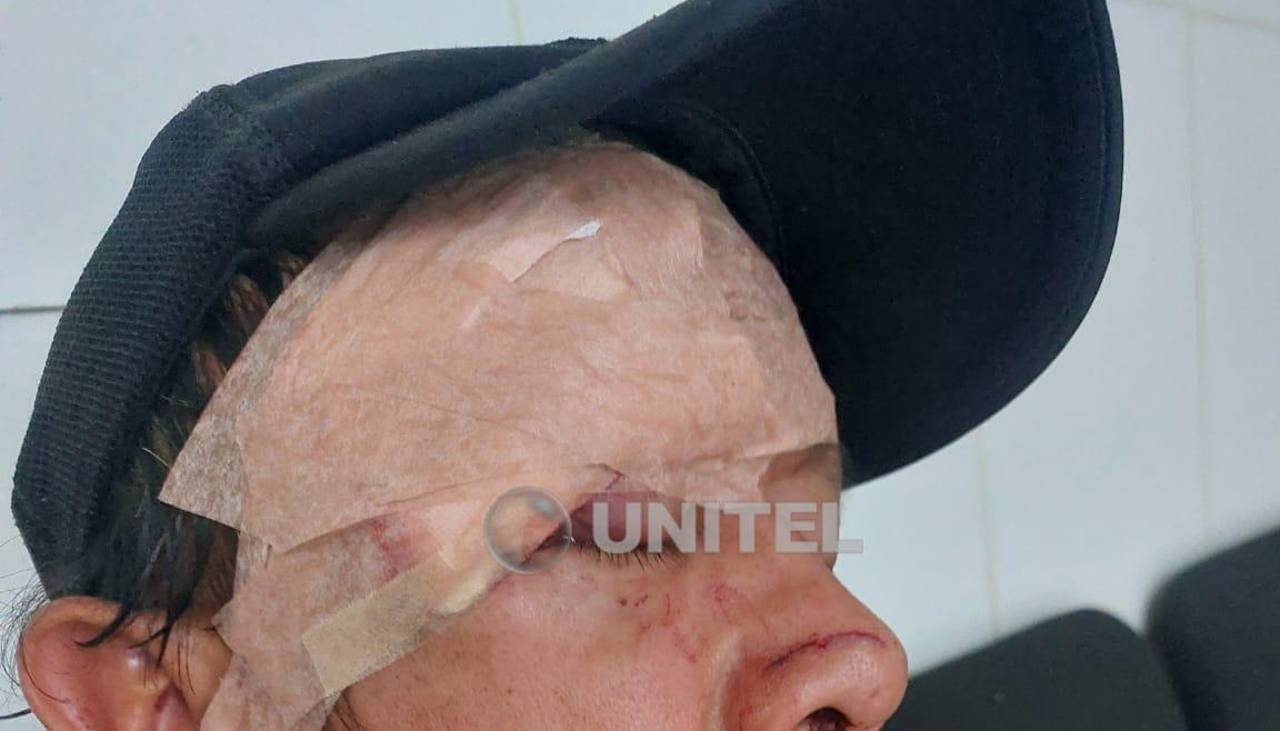 Hombre que intentó defender a una persona es herido con machete durante una pelea de pandillas