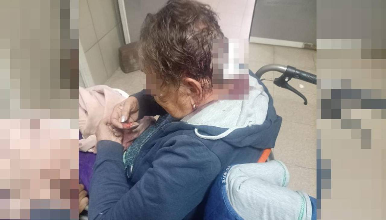 Delincuentes golpean en la cabeza con un ladrillo a una adulta mayor para robarle sus pertenencias