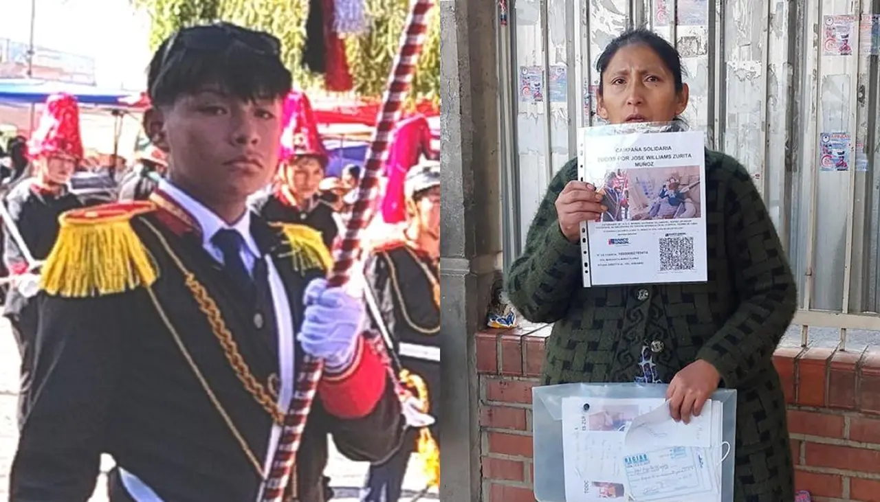 Adolescente salió a jugar wally con sus amigos y terminó terapia intensiva con una lesión en la cabeza y el rostro