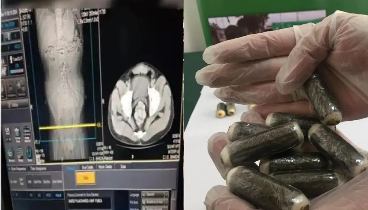 Detienen en Argentina a un boliviano que tragó 54 cápsulas de droga; su estado de salud es grave 