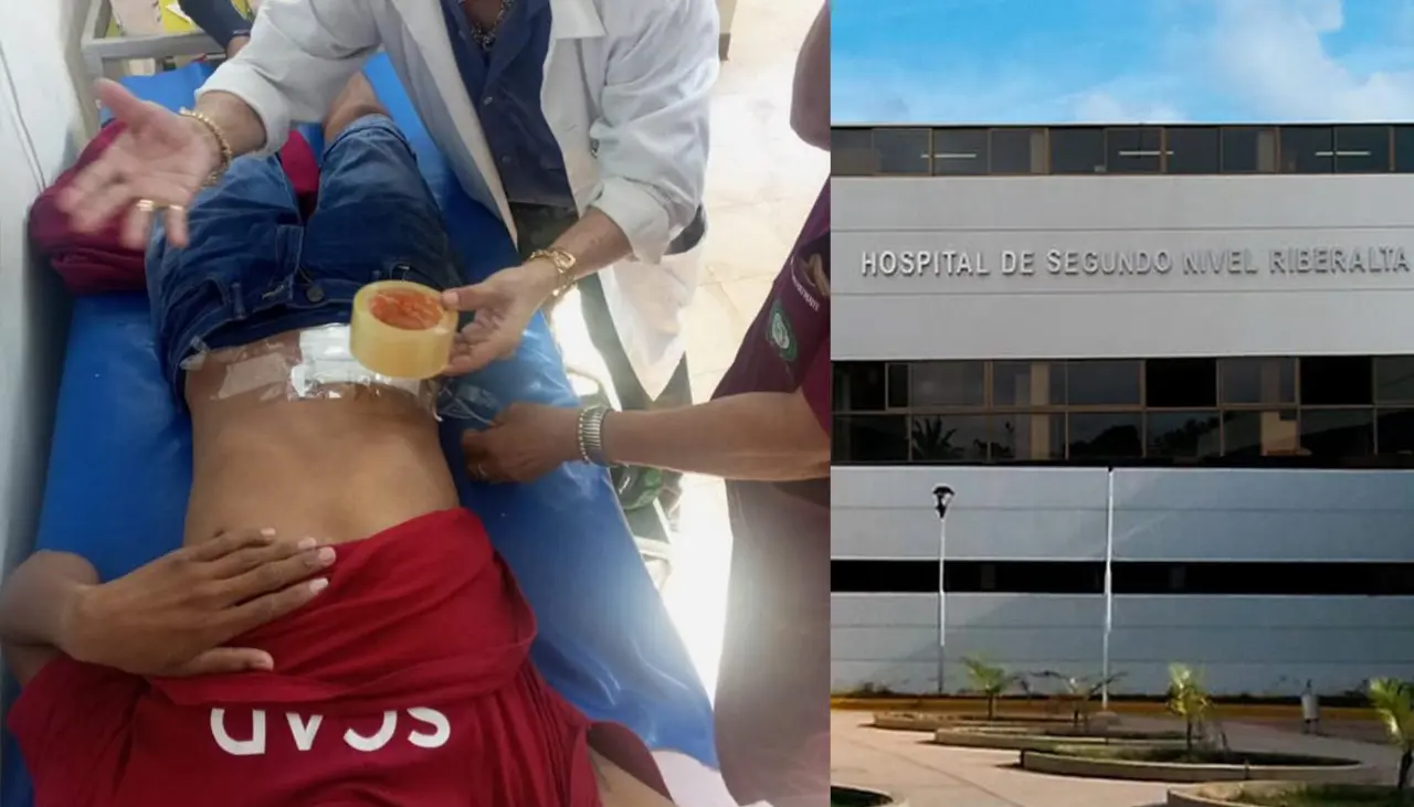 Denuncian uso ‘yúrex’ en lugar de cinta médica en un hospital de Riberalta; Alcaldía dice que no hubo “pedido formal” del insumo