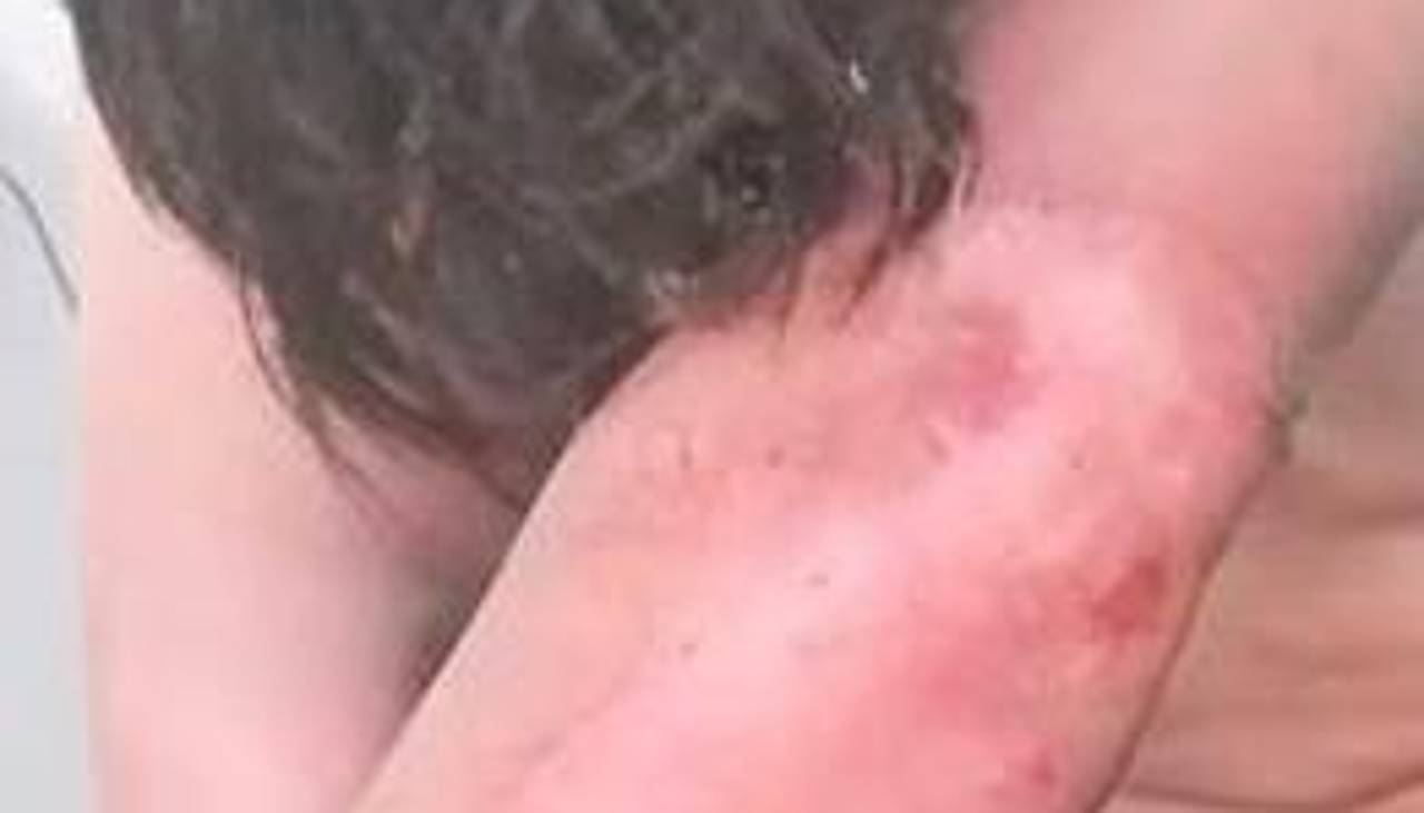 Hombre ebrio casi mata a su pareja al prender fuego a su casa