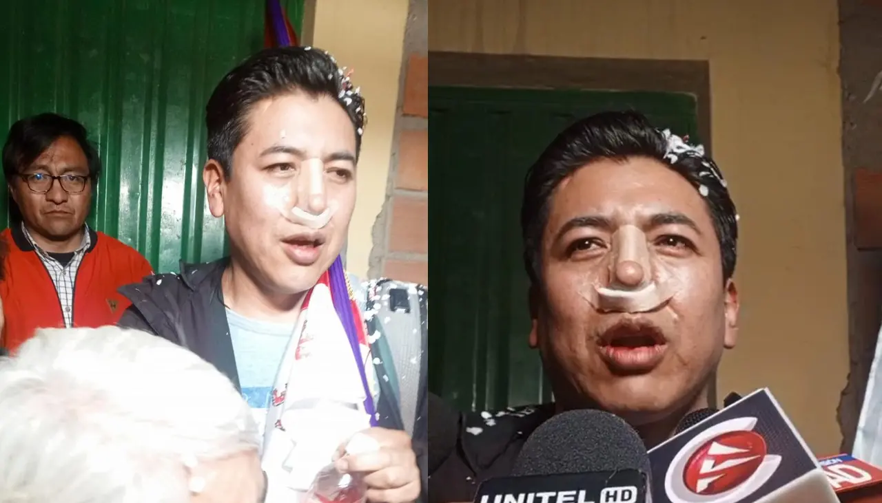 Pumari habla de la lesión que sufrió en la nariz y denuncia que no le permitieron asistir a segunda cirugía
