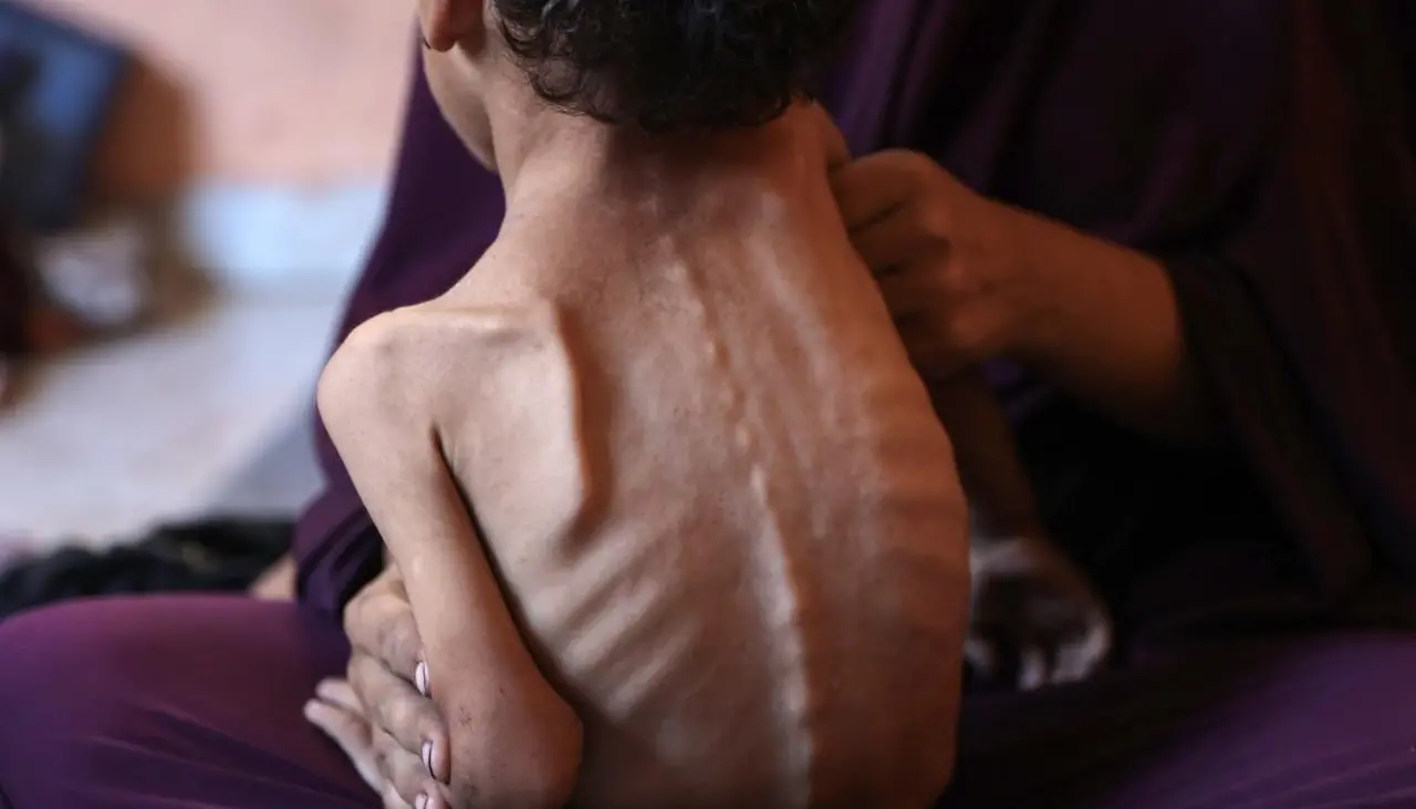Crisis del hambre en Gaza: Uno de cada tres habitantes no come varios días, señala el Programa Mundial de Alimentos