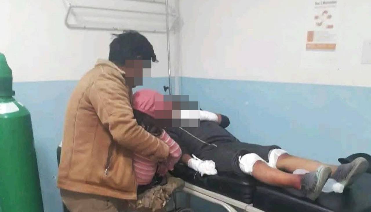 “Perdió cuatro dedos”: Un niño queda herido por la detonación de una “bomba molotov” que cayó en su casa en los bloqueos
