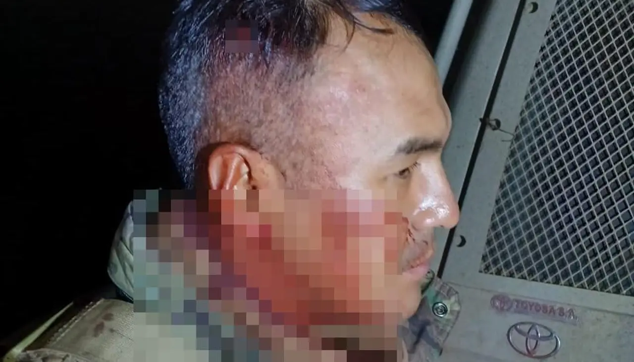Contrabandistas atacan a agentes en la ruta hacia Desaguadero, dejan cinco heridos y roban una pistola 