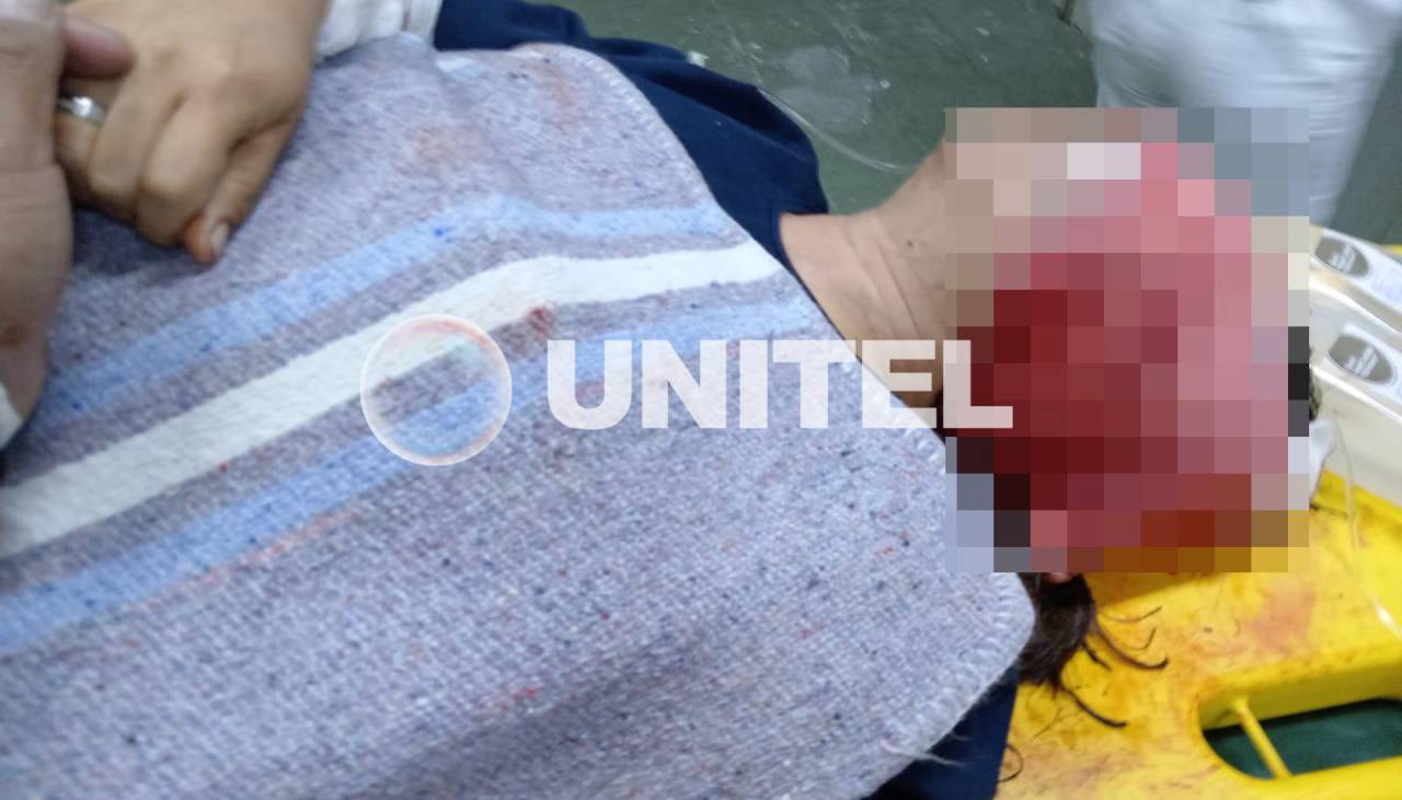 Hallan a una mujer golpeada, apuñalada y con quemaduras dentro del penal de El Abra