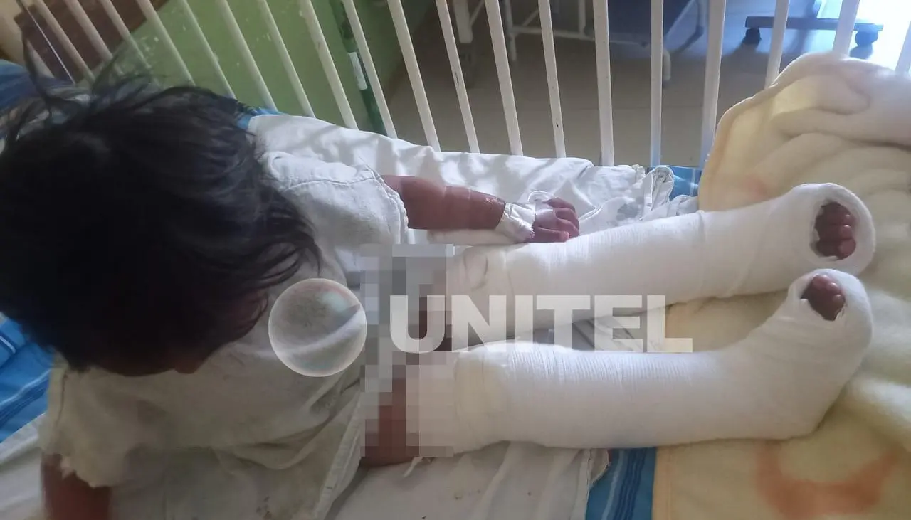 Niña atropellada será operada por tercera vez, los padres denuncian que el conductor solo les dio Bs 100 para los gastos