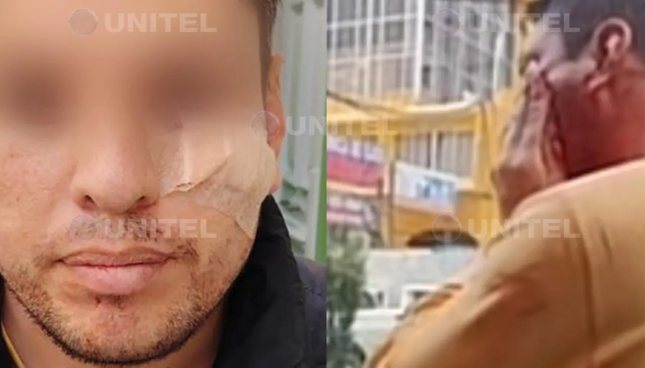 Video: Chófer le provoca un corte en la cara a un pasajero que le reclamó porque no paró donde le pidió