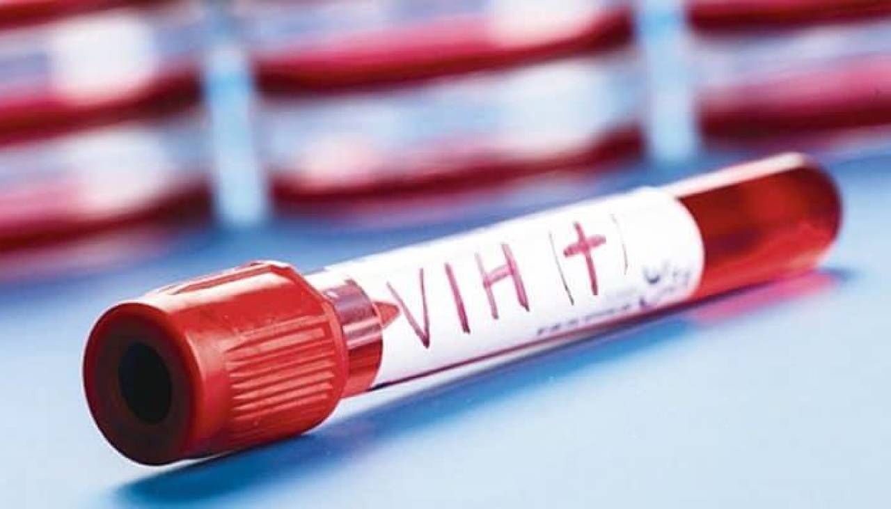 Alarma en Pando por el incremento de casos de VIH, que ya alcanzan a 19 en esta gestión