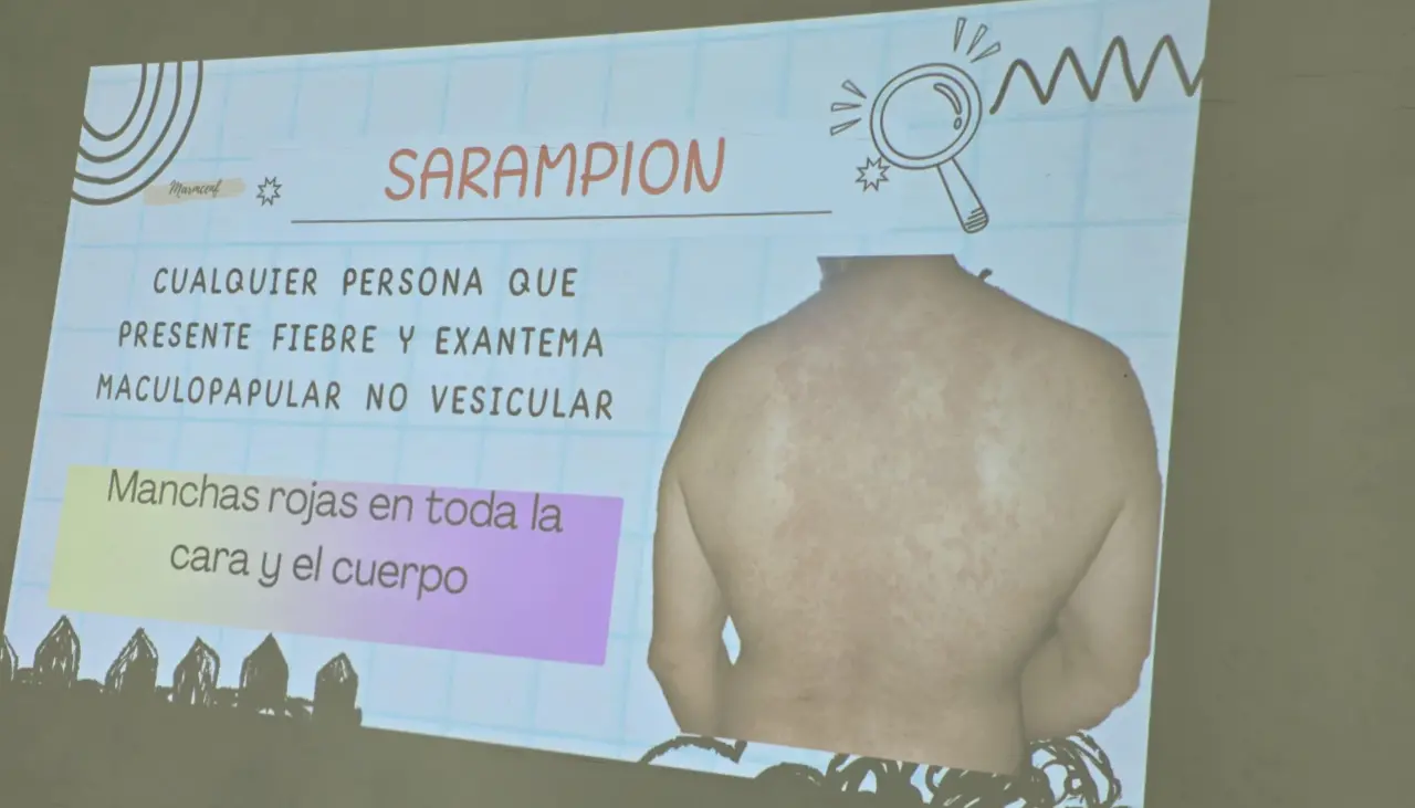Suben a 14 los casos de sarampión en Santa Cruz; seis hermanos no vacunados, son los últimos afectados