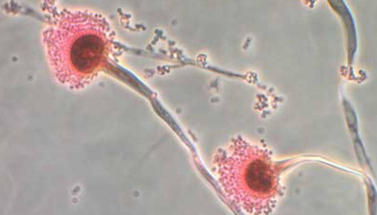 Aspergillus, el hongo que puede “comerte por dentro” preocupa a los científicos
