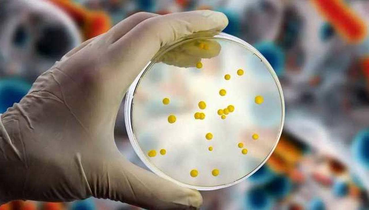 Sedes aclara que no se han reportado más casos de la bacteria Streptococcus y pide a la población no alarmarse