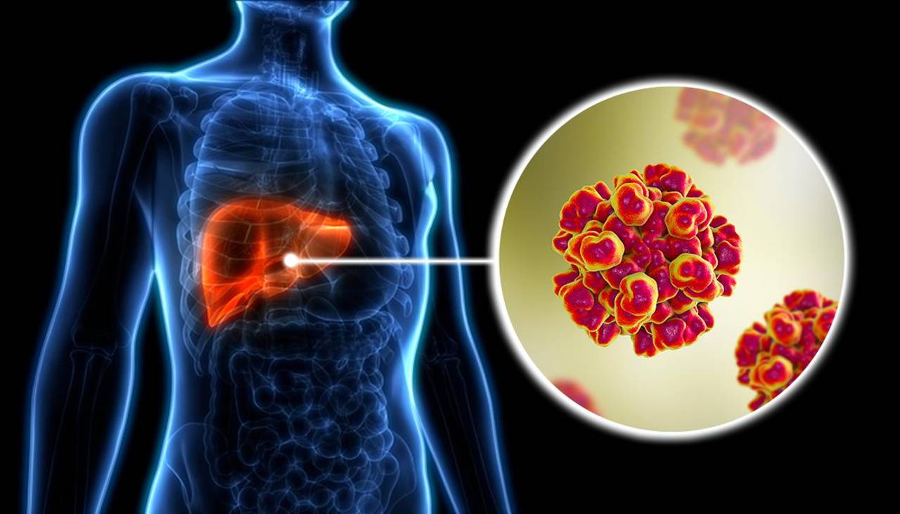 Sedes confirma 10 casos de hepatitis en un colegio de Cochabamba, cuatro de ellos están internados
