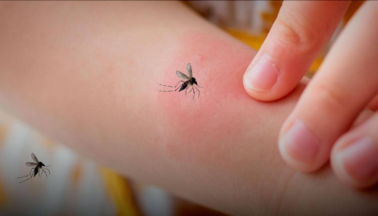 Santa Cruz y Cochabamba son los departamentos más afectados por la chikungunya, confirmó la ministra de salud