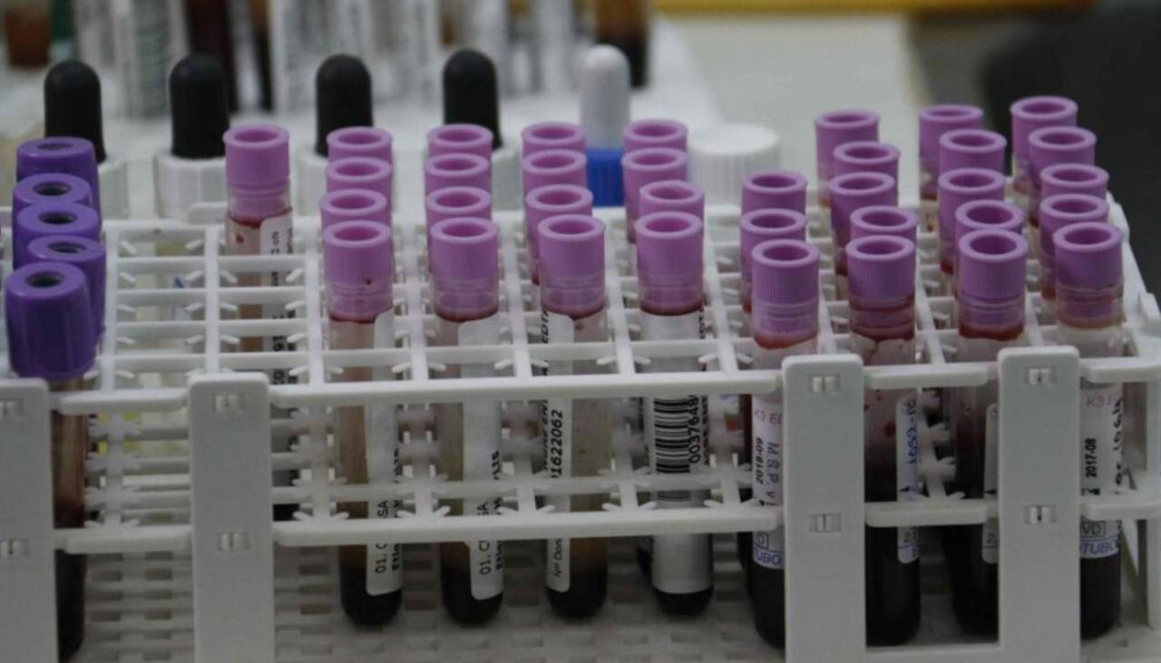 IA y el aprendizaje automático ayudarían a detectar a personas en riesgo de sufrir cáncer