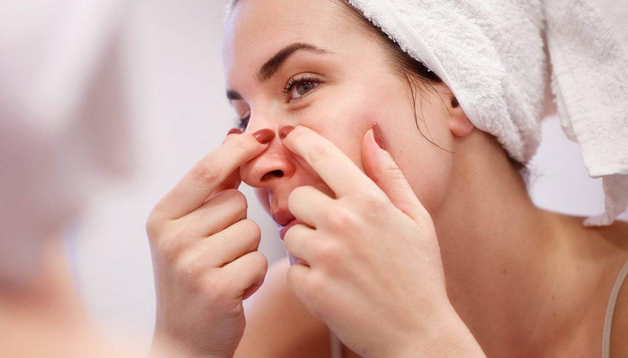 Video: ¿Dónde está el ‘triángulo de la muerte’ en la cara y por qué reventarse un grano puede mandarte al hospital?