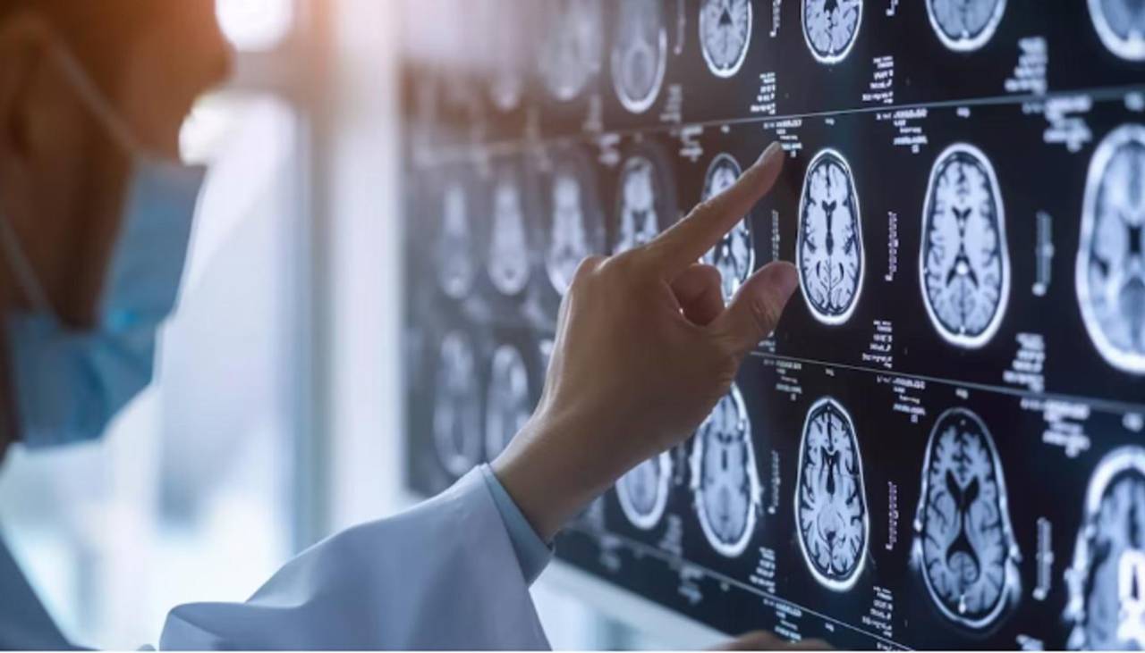Primer paciente del mundo sometido a una cirugía cerebral asistida por IA en tiempo real