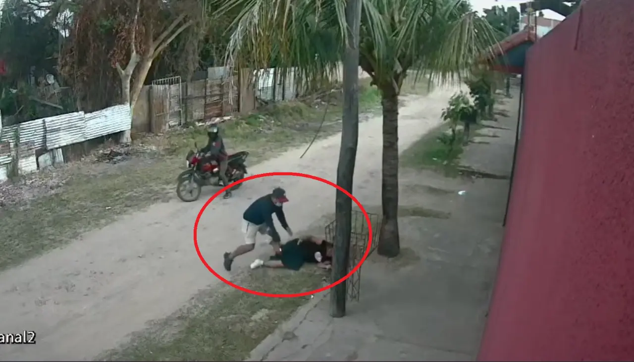 Imágenes sensibles: Una joven recibe una patada en la cara al ser asaltada en Santa Cruz