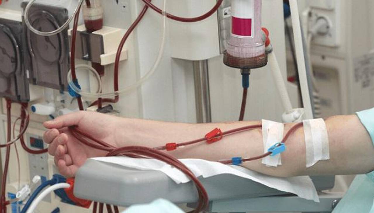 Salud reconoce deuda de Bs 500 millones y promete pagos progresivos a centros de hemodiálisis