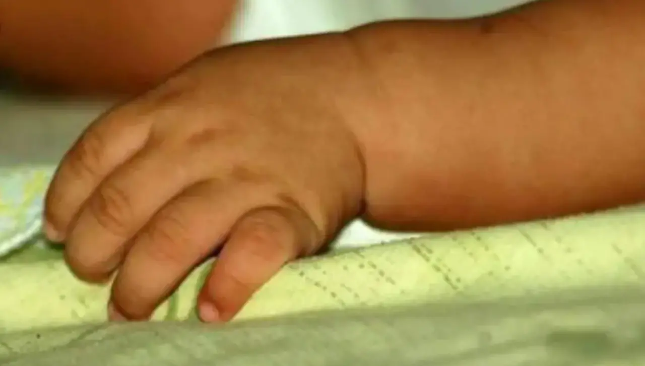 Niña de dos años perdió dos dedos con una amoladora, sus padres piden ayuda para pagar gastos médicos