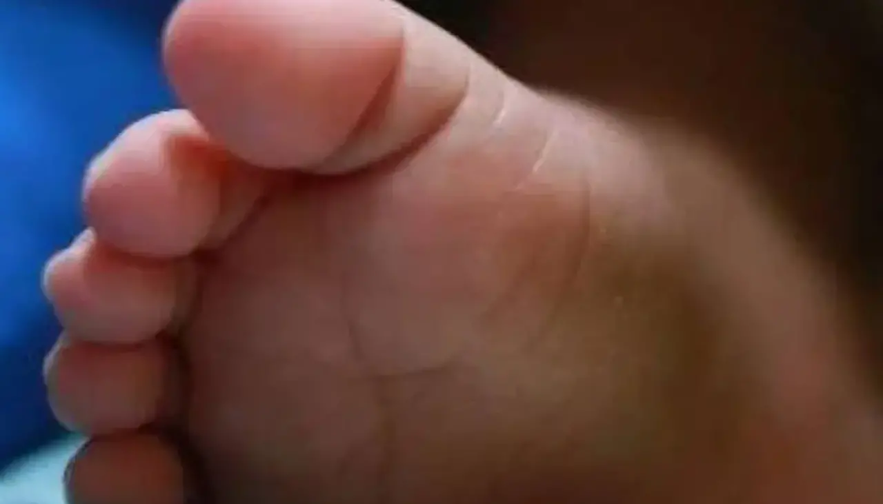 Beni reporta su primer caso de sarampión, se trata de una niña procedente en Santa Cruz