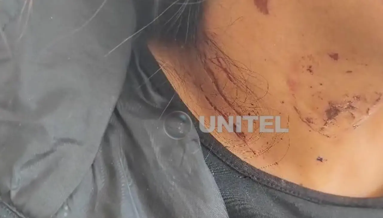 Mujer denuncia tentativa de feminicidio después de ser atacada por un hombre con una tijera en un alojamiento