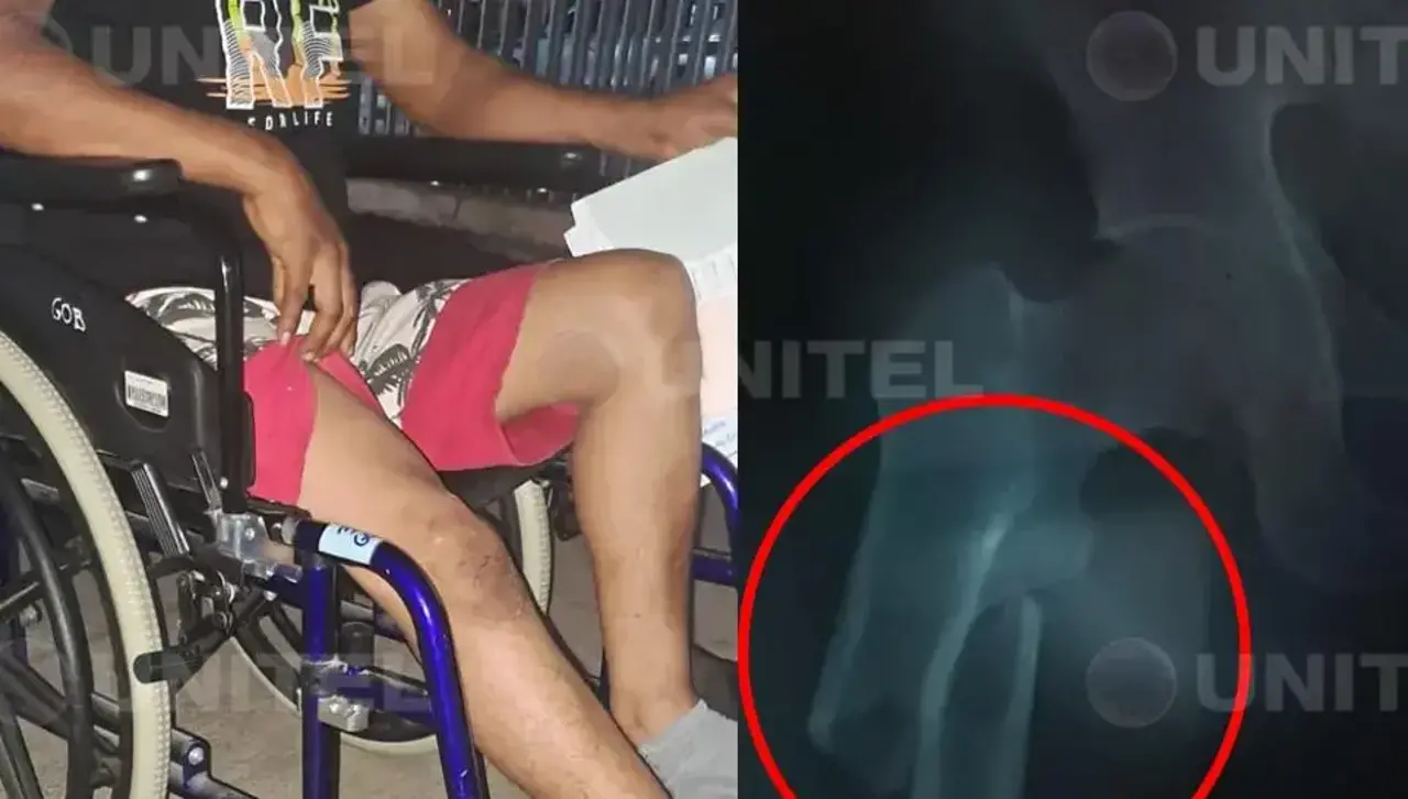 “Me pegaron y me atropellaron” dice mecánico atracado que quedó con una pierna fracturada