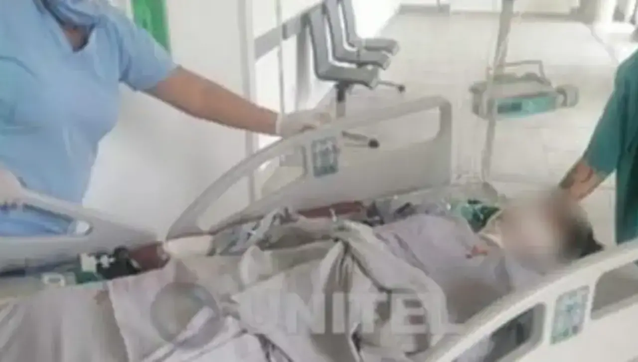 Muere el hombre que fue quemado vivo en Shinahota tras ser acusado de robar un vehículo