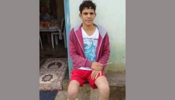 Se amputó un pie para recibir  una ‘millonaria indemnización’ del seguro, pero fue condenado por la Justicia