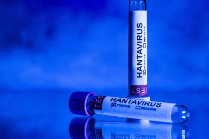 El paciente español que dio positivo por hantavirus presenta síntomas
