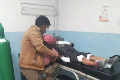 “Perdió cuatro dedos”: Un niño queda herido por la detonación de una “bomba molotov” que cayó en su casa en los bloqueos