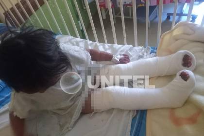 Niña atropellada será operada por tercera vez, los padres denuncian que el conductor solo les dio Bs 100 para los gastos