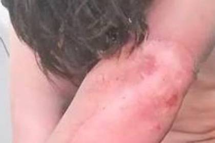 Hombre ebrio casi mata a su pareja al prender fuego a su casa