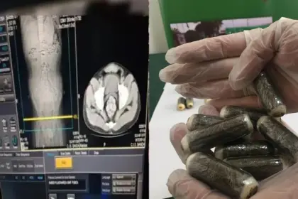 Detienen en Argentina a un boliviano que tragó 54 cápsulas de droga; su estado de salud es grave 