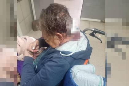 Delincuentes golpean en la cabeza con un ladrillo a una adulta mayor para robarle sus pertenencias