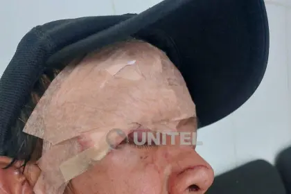 Hombre que intentó defender a una persona es herido con machete durante una pelea de pandillas