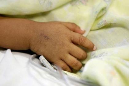“En los pulmones tenía leche”, autopsia revela que bebé murió atragantado tras lactar