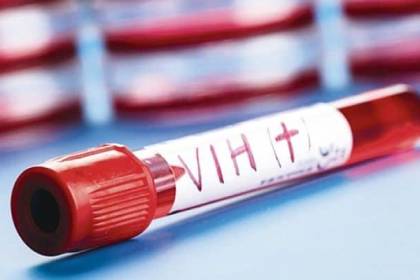 Alarma en Pando por el incremento de casos de VIH, que ya alcanzan a 19 en esta gestión