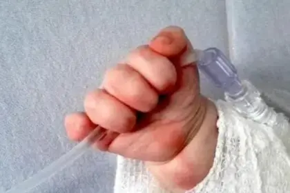 Formalizan denuncia contra personal médico donde un recién nacido sufrió quemaduras 