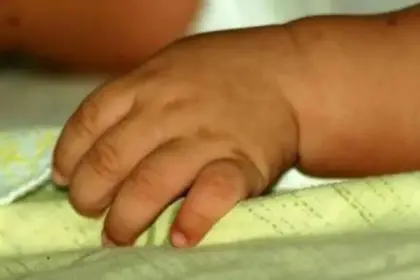 Niña de dos años perdió dos dedos con una amoladora, sus padres piden ayuda para pagar gastos médicos
