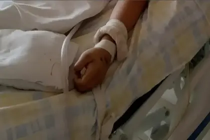 Confirman que interna de medicina falleció con rabia humana; es el primer caso de 2025 en Cochabamba