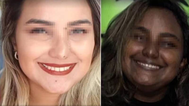 Sabrina antes y después de la extirpación de sus glándulas suprarrenales 