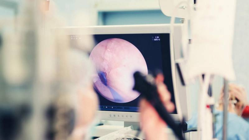 Endoscopia digestiva para el diagnóstico de un posible problema de salud